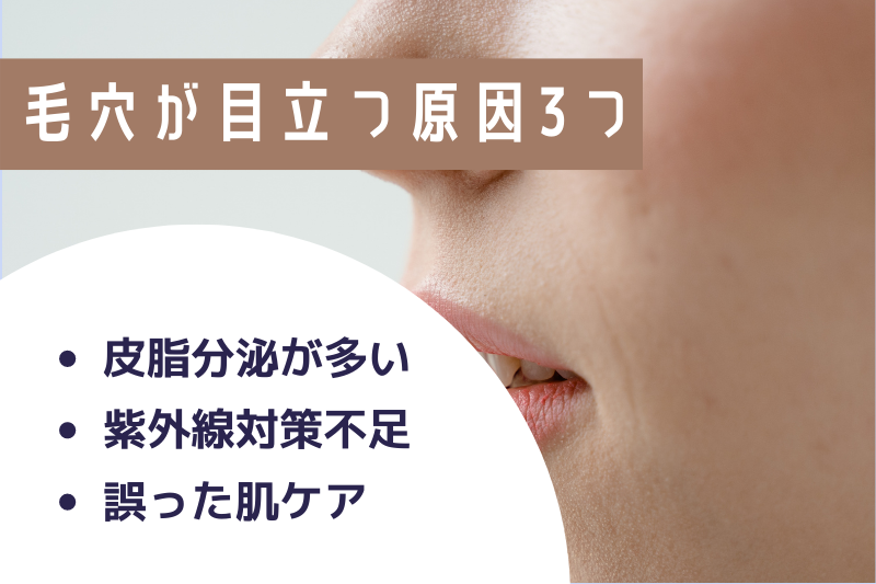 毛穴が目立つ原因3つ
・皮脂分泌が多い
・紫外線対策不足
・誤った肌ケア