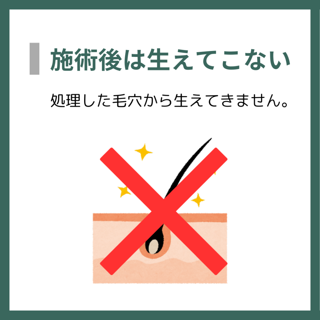 施術後は生えてこない
処理した毛穴から生えてきません。