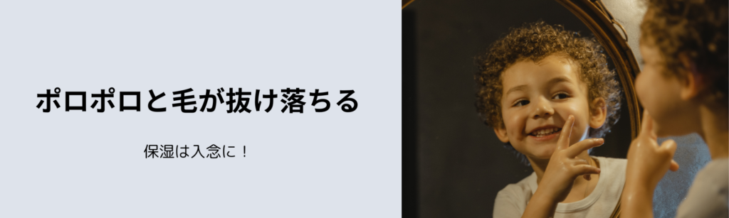 ポロポロと毛が抜け落ちる
保湿は入念に！